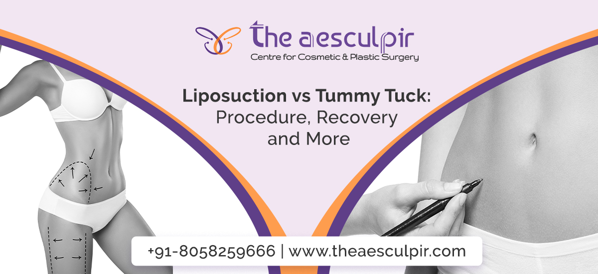 Liposuction vs. Tummy Tuck: Things You Need to Know